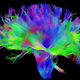 Illustration for article titled The Dramatic Differences in Male and Female Brain Connectivity